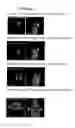 Fig. 01 - Nitro-imidazole hypoxia imaging agent