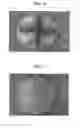 Fig. 05 - Probiotic compositions and process thereof