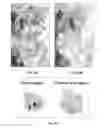 Fig. 04 - Lymph nodes as a site for regeneration