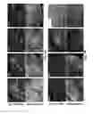 Fig. 07 - Lymph nodes as a site for regeneration
