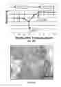 Fig. 14 - Lymph nodes as a site for regeneration