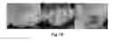 Fig. 23 - Lymph nodes as a site for regeneration