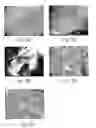 Fig. 06 - Random ethylene oxide copolymer and non-random alkylene oxide(s) polymer with bioactive agent