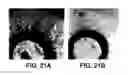 Fig. 31 - ANTAGONISTS OF NEUROPILIN RECEPTOR FUNCTION AND USE THEREOF