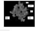 Fig. 01 - Hepatitis C virus antibodies