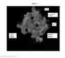 Fig. 10 - Hepatitis C virus antibodies