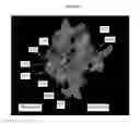 Fig. 11 - Hepatitis C virus antibodies