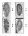 Fig. 13 - Antibodies that specifically bind hedgehog-derived polypeptides