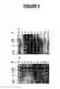 Fig. 12 - Modified leukotoxin gene and protein