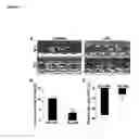 Fig. 04 - MCPIP Protection Against Cardiac Dysfunction