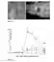 Fig. 13 - Normuramyl glycopeptide compounds