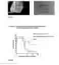 Fig. 14 - Normuramyl glycopeptide compounds