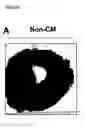 Fig. 02 - MESENCHYMAL STEM CELL PARTICLES