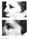 Fig. 02 - Topical compositions for anti-aging and methods of using same