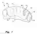 Fig. 02 - System for vacuum formation of dental appliance