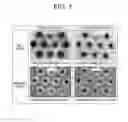 Fig. 07 - Method of forming a through hole by laser drilling