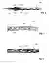 Fig. 03 - Uncured composite rope including a plurality of different fiber materials
