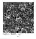Fig. 03 - Spinulose titanium nanoparticulate surfaces