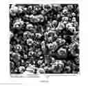 Fig. 17 - Spinulose titanium nanoparticulate surfaces