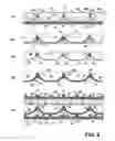 Fig. 09 - Solid oxide electrolytic device