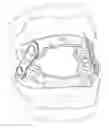 Fig. 01 - Dental Appliance
