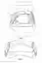 Fig. 02 - Dental Appliance