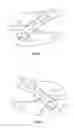 Fig. 03 - Dental Appliance