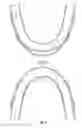 Fig. 04 - Dental Appliance