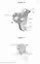 Fig. 08 - INDIRECT RESTORATION PLACEMENT TOOL AND PROCESS