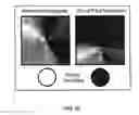 Fig. 41 - METHOD FOR DETECTION OF PRE-NEOPLASTIC FIELDS AS A CANCER BIOMARKER IN ULCERATIVE COLITIS
