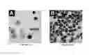 Fig. 13 - FETAL ANEUPLOIDY DETECTION BY SEQUENCING