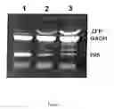 Fig. 05 - Method of profiling gene expression in a healthy subject
