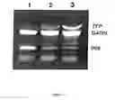 Fig. 05 - Method of profiling gene expression in a subject undergoing a treatment