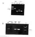 Fig. 01 - Method of profiling gene expression in a subject having diabetes