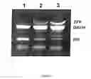 Fig. 05 - Method of profiling gene expression in a subject having diabetes
