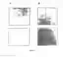 Fig. 07 - Method of profiling gene expression in a subject having diabetes