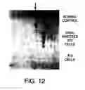 Fig. 13 - NUCLEOTIDE AND PROTEIN SEQUENCE OF MAMMASTATIN AND METHODS OF USE