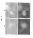 Fig. 05 - METHOD OF PREPARING INDUCED PLURIPOTENT STEM CELLS DEPRIVED OF REPROGRAMMING GENE