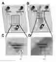 Fig. 01 - Microfluidic gradient devices
