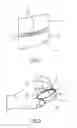 Fig. 03 - Cell culture dish