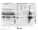 Fig. 11 - Compositions and methods of use for MGD-CSF in disease treatment