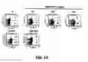 Fig. 18 - Compositions and methods of use for MGD-CSF in disease treatment