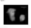 Fig. 16 - Identification and characterization of cancer stem cells and methods of use
