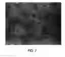 Fig. 08 - Methods of making enhanced, autologous fat grafts