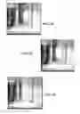 Fig. 09 - System and method for magnetically concentrating and detecting biomarkers