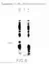 Fig. 11 - Tumor necrosis factor-gamma