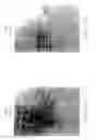 Fig. 19 - Tumor necrosis factor-gamma