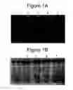 Fig. 02 - Methods, Kits and Compositions for the Identification of Nucleic Acids Electrostatically Bound to Matrices