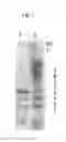Fig. 05 - Fungal protease and use thereof