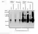 Fig. 02 - ABNORMAL PROTEIN REMOVING METHOD